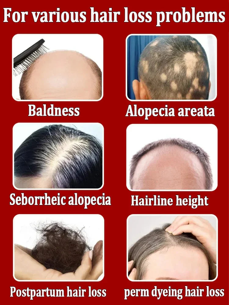 Hair growth essential oil, effectively repair baldness and hair loss, new hair growth