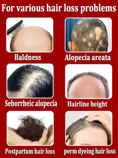 Hair growth essential oil, effectively repair baldness and hair loss, new hair growth